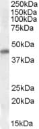 Polyclonal Goat anti-Human NKX2-5 Antibody (aa94-107, IHC, IF, WB)