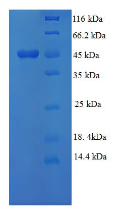 Human MAPK3 / ERK1 Protein (Recombinant His)