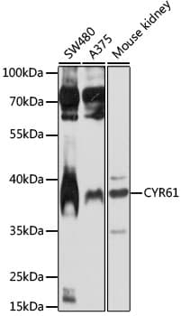 CYR61 Antibody (aa120-220)