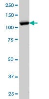IHC-plus™ IPO5 / RANBP5 Antibody (clone 1C4)