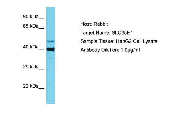 SLC35E1 Antibody (aa323-372)