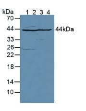 Aspartate Aminotransferase Antibody (aa1-413)