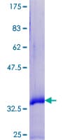 Human SPRR2F Protein (Recombinant GST)