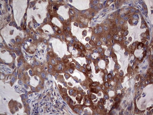 Monoclonal Mouse anti-Human PKM2 Antibody (clone 1F12, IHC, WB)