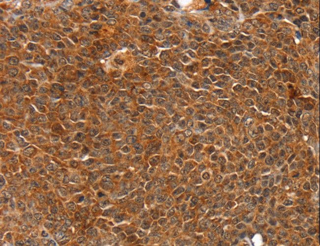Polyclonal Rabbit anti-Human CARP / ANKRD1 Antibody (IHC, WB)
