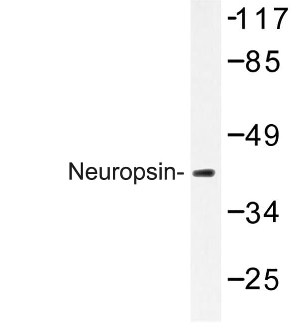OPN5 / Neuropsin Antibody (Gln286)
