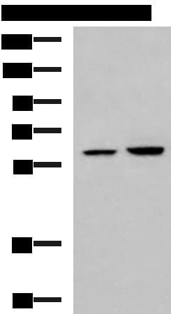 Polyclonal Rabbit anti-Human FKBP4 / FKBP52 Antibody (IHC, WB)