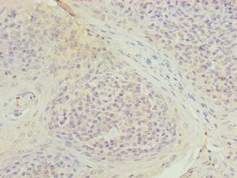 Polyclonal Rabbit anti-Human TUBB1 / Tubulin Beta 1 Antibody (IHC, WB)