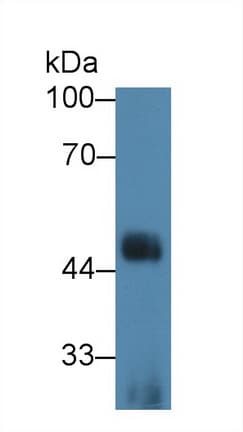 IL1RL1 Antibody (aa162-349)