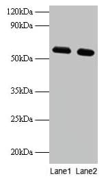 PHGDH Antibody