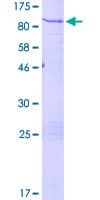 Human CHGA / Chromogranin A Protein (Recombinant GST)