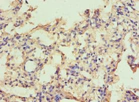 CAPN1 / Calpain 1 Antibody (aa20-330)