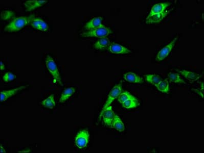 SPPL2A / IMP3 Antibody