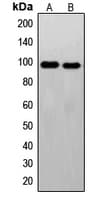 FER Antibody (C-Terminus)