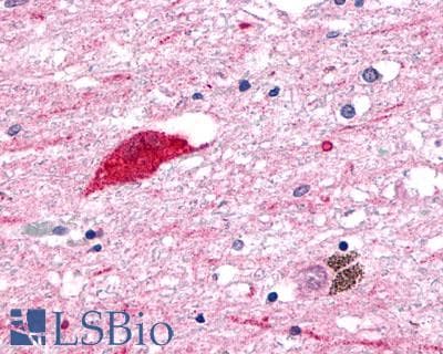 PathPlus™ GPR1 Antibody (C-Terminus)
