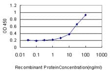 GBA / Glucosidase Beta Acid Antibody (clone 2e2)