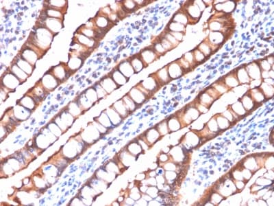 VIL1 / Villin Antibody (aa179-311, clone rVIL1/1325, Azide-free, Carrier-free)