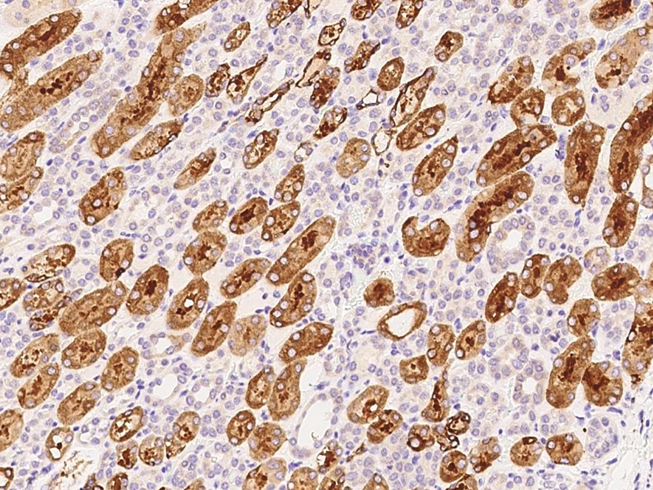 Polyclonal Rabbit anti-Human CRYAB / Alpha B Crystallin Antibody (Preservative Free, IHC, WB)