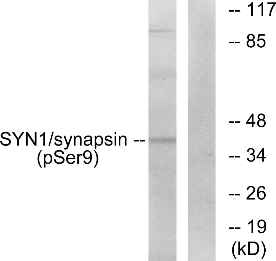 Polyclonal Rabbit anti-Human SYN1 / Synapsin 1 Antibody (phospho-Ser9, WB)