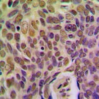 BRMS1 Antibody (Internal)