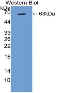 CCND1 / Cyclin D1 Antibody (aa1-295)
