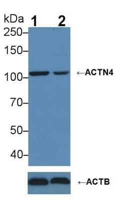 Polyclonal Rabbit anti-Human ACTN4 Antibody (aa1-269, WB)
