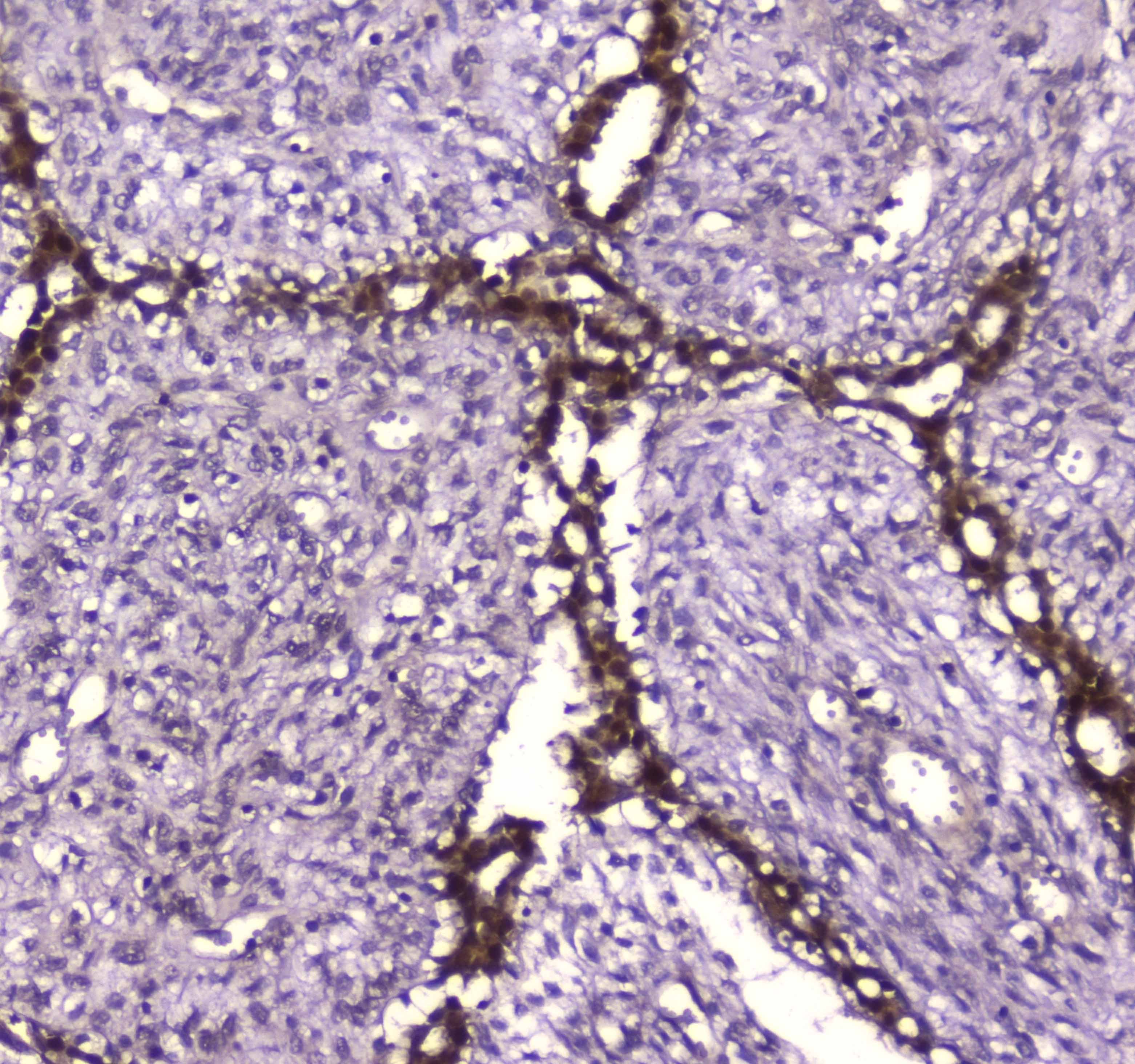 GSR / Glutathione Reductase Antibody