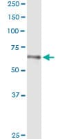 HLX1 / HLX Antibody (clone 1B9)
