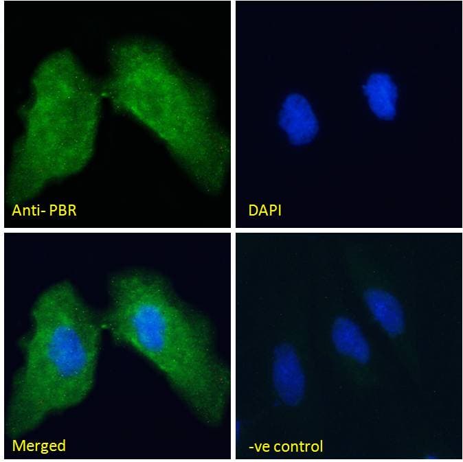 IHC-plus™ Polyclonal Goat anti-Mouse TSPO / PBR Antibody (aa156-169, IHC, IF, WB)
