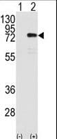 Polyclonal Rabbit anti-Human PRKCH / PKC-Eta Antibody (aa210-239, IHC, WB)