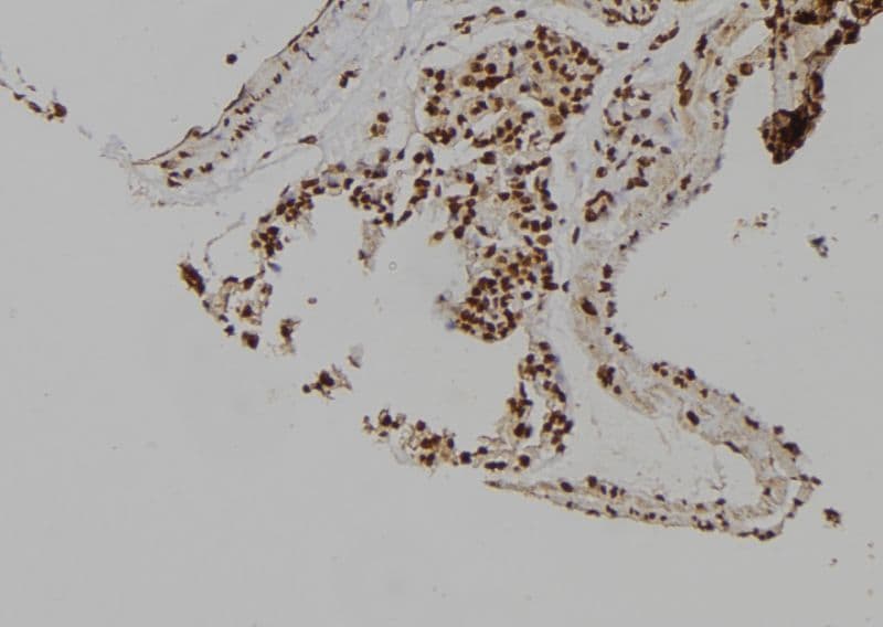 Polyclonal Rabbit anti-Human MCM6 Antibody (IHC, WB)