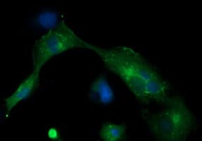 MLANA / Melan-A Antibody (clone OTI1F12)