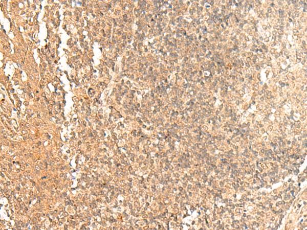 GTF3A Antibody