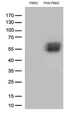 PDCD1 / CD279 / PD-1 Antibody (clone UMAB197)