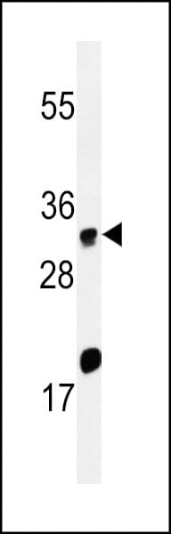 Polyclonal Rabbit anti-Human HELO1 / ELOVL5 Antibody (aa271-299, WB)