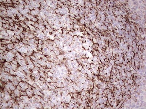 Monoclonal Mouse anti-Human DMN / Desmuslin / Synemin Antibody (clone 2F4, Carrier-free, aa329-580, IHC)