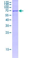 Human HLA-C Protein (Recombinant GST)