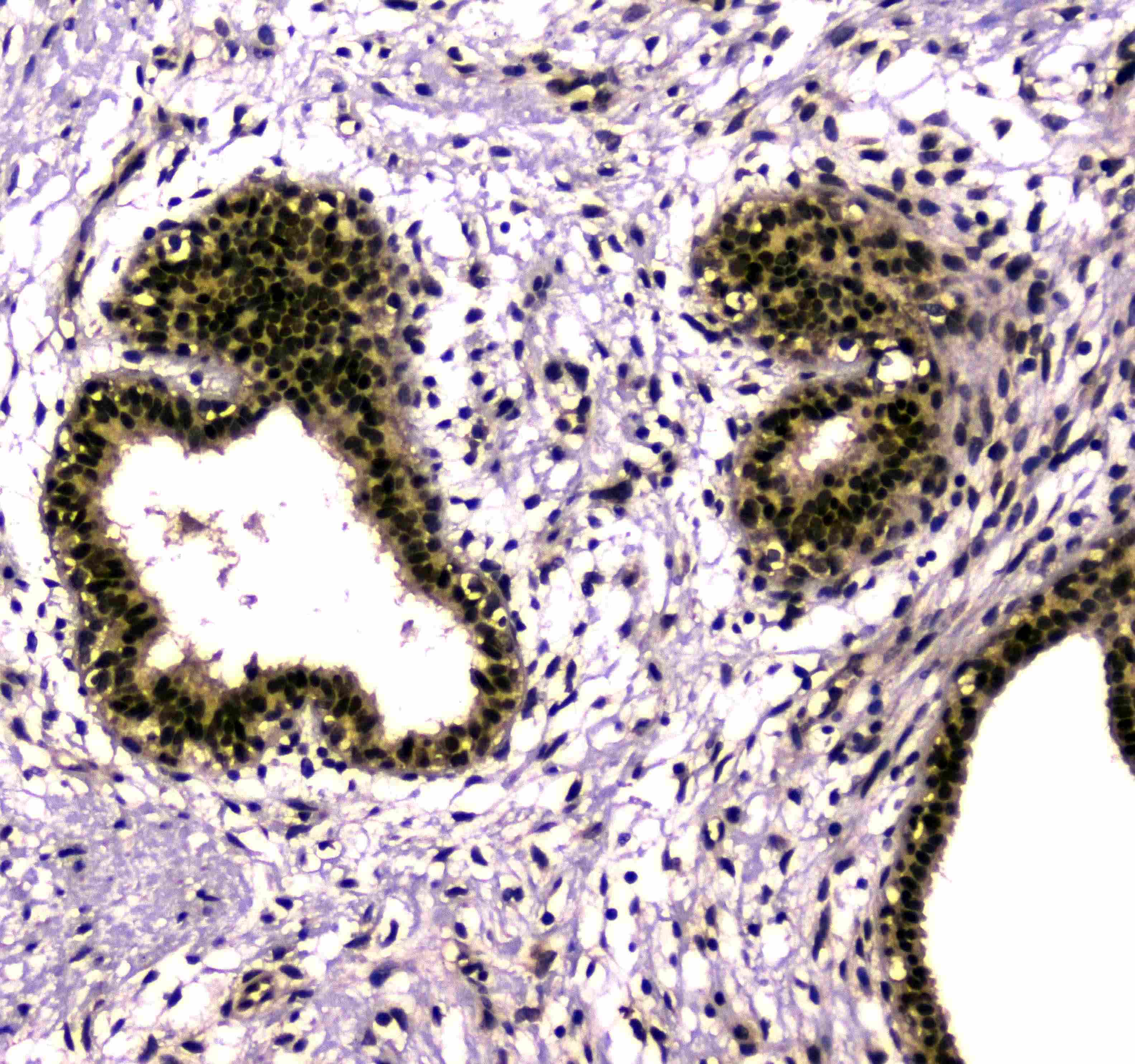 SAE2 / UBA2 Antibody