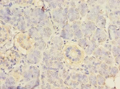 RPS24 / Ribosomal Protein S24 Antibody