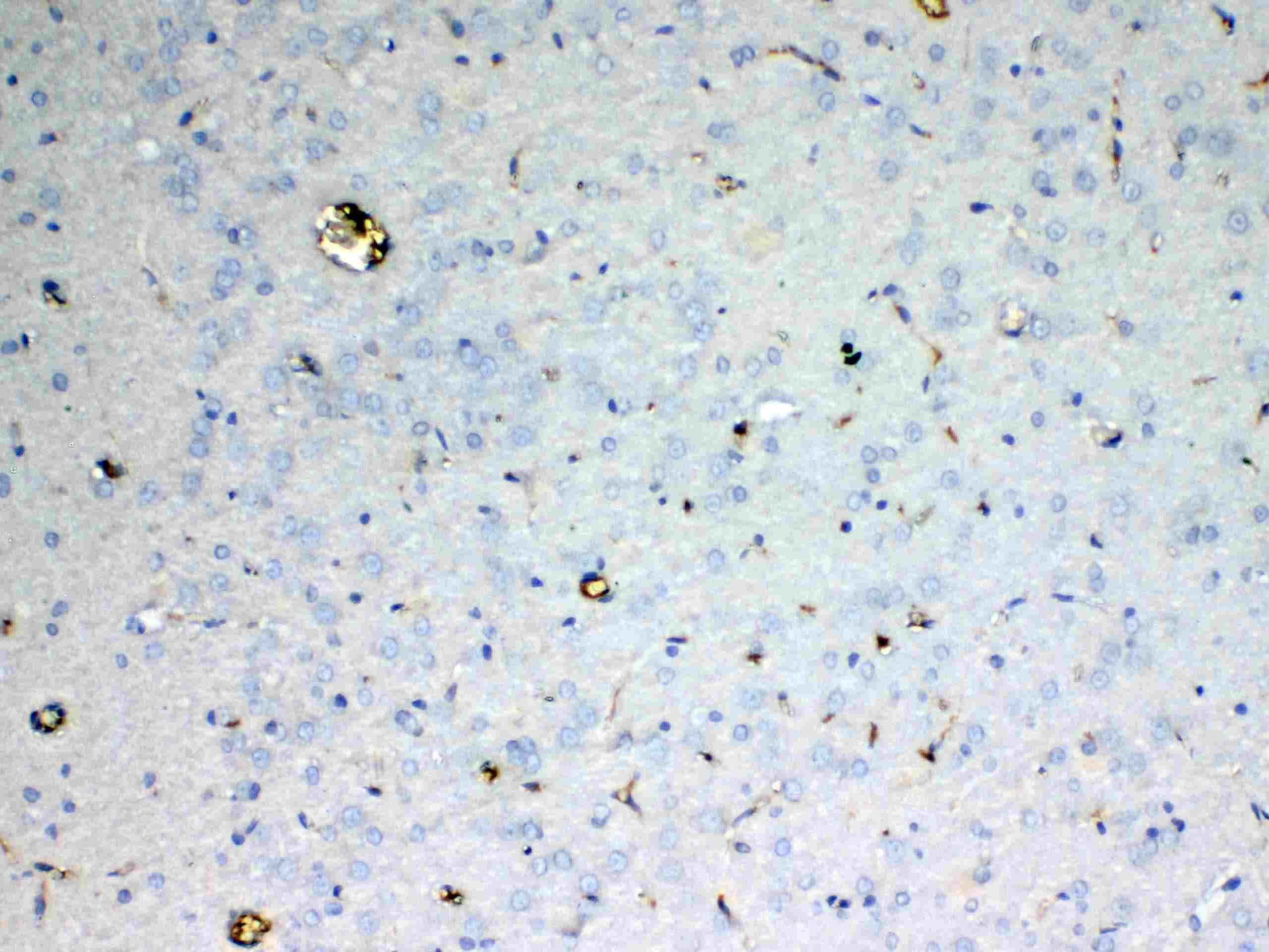Polyclonal Rabbit anti-Rat ADA / Adenosine Deaminase Antibody (IHC, WB)