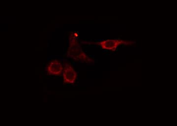 Polyclonal Rabbit anti-Human AGBL2 / CCP2 Antibody (IHC, IF, WB)