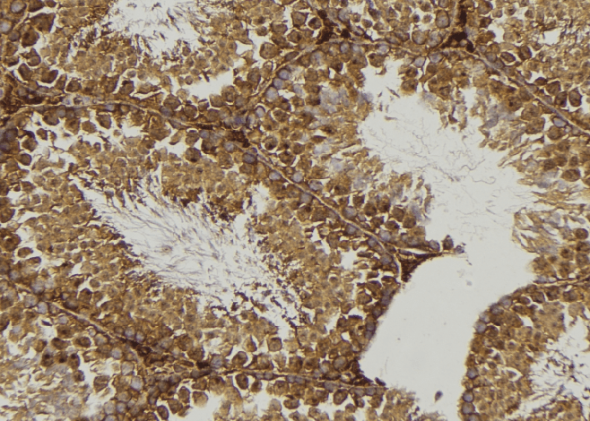Polyclonal Rabbit anti-Human GJA1 / CX43 / Connexin 43 Antibody (IHC, WB)