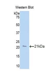 PRDX2 / Peroxiredoxin 2 Antibody (aa6-164, PE)