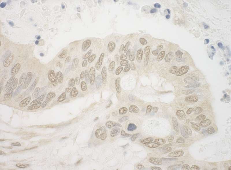 ARNT / HIF-1-Beta Antibody (aa1-50)