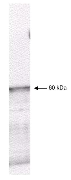 Polyclonal Rabbit anti-Human PDPK1 / PDK1 Antibody (C-Terminus, IHC, WB)