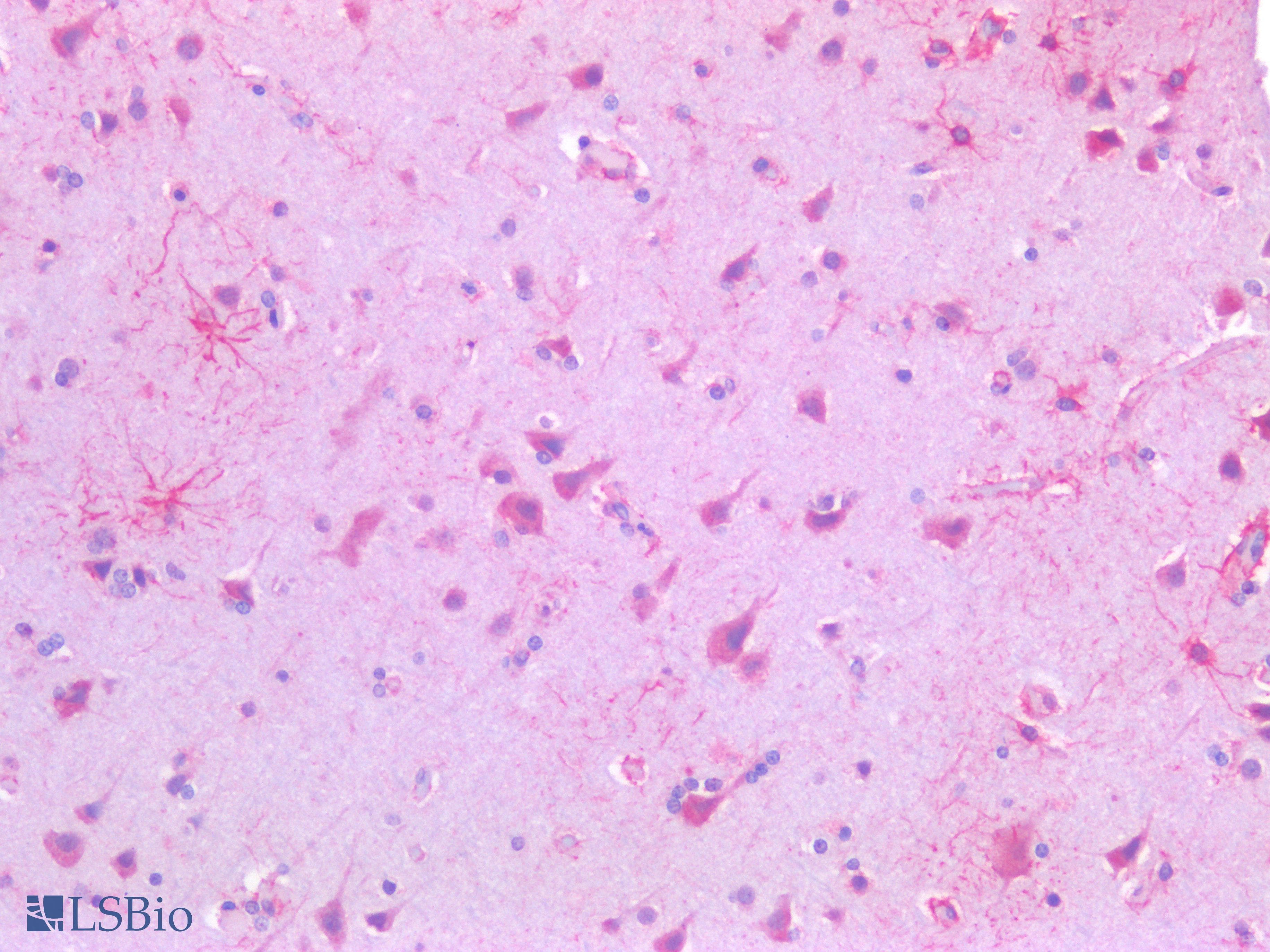 PathPlus™ USP19 Antibody
