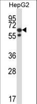 Polyclonal Rabbit anti-Human PPM1G Antibody (aa64-92, WB)