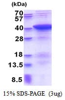 Human PDLIM1 Protein (Recombinant His)