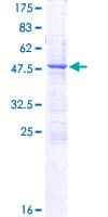 Human C1QTNF3 / CTRP3 Protein (Recombinant GST)