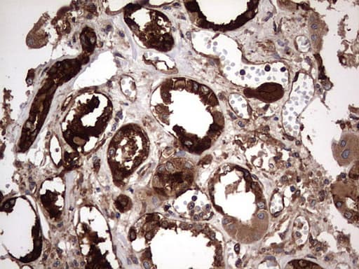 KRT7 / CK7 / Cytokeratin 7 Antibody (clone OTI2A2)